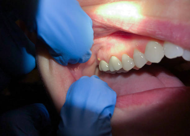Best Pediatric Emergency Dentist in Graysville, AL